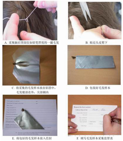 法医毒物鉴定